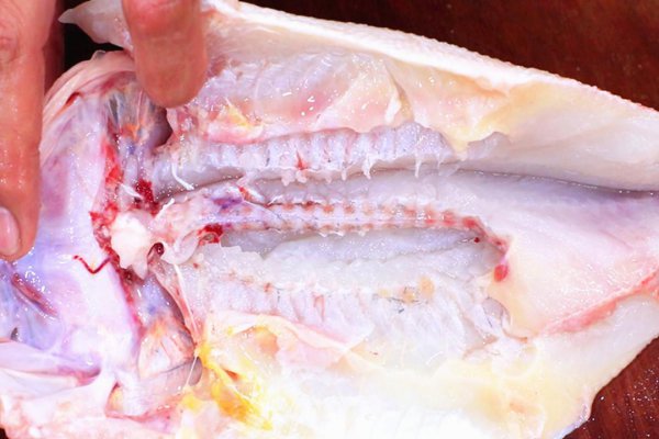 高三学生吃什么补脑增强记忆力