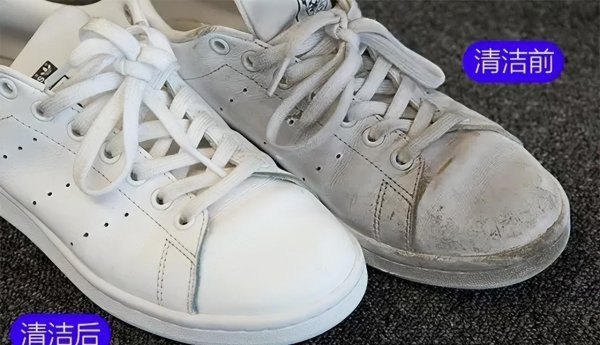 白鞋子上的黄污渍怎么去掉