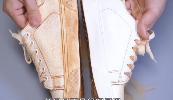 白鞋子上的黄污渍怎么去掉