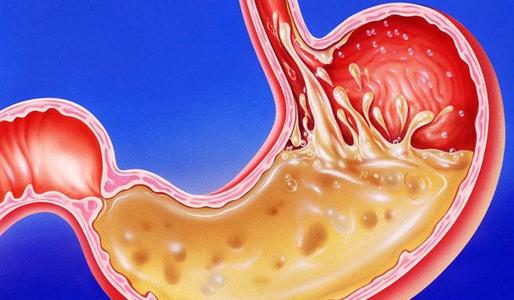 液体面包指的是什么东西