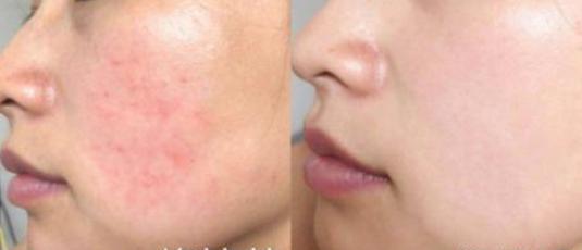 海藻面膜用什么水调最好