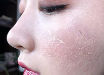 搓泥是什么原因引起的 化妆后总是搓泥怎么办才好