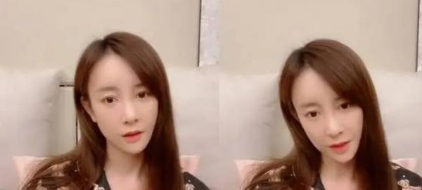 张檬为什么要整容