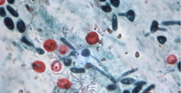 霸王龙的天敌是什么动物