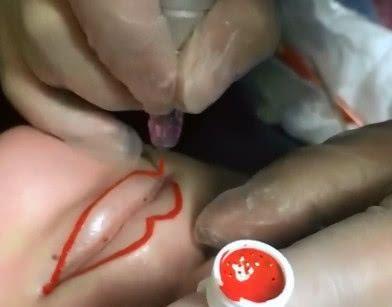 纹唇和涂口红哪个伤害大