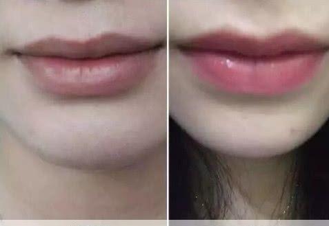 纹唇和涂口红哪个伤害大