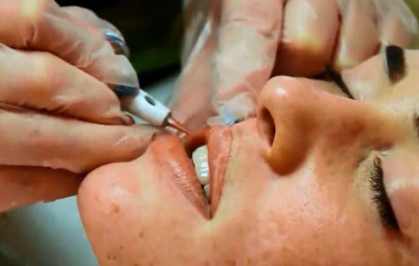 纹唇和涂口红哪个伤害大