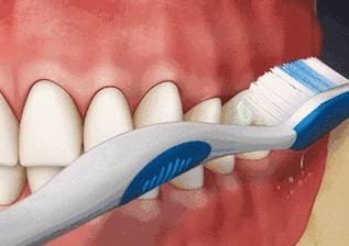 用电动牙刷好还是手动牙刷好