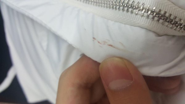 衣服上血渍去除小窍门