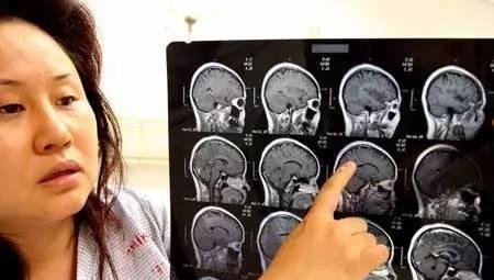 外来物种有哪些