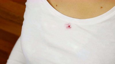 衣服上血渍去除小窍门 如何快速清理掉衣服上的血迹