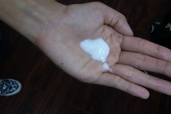 老人斑只有老人会长吗