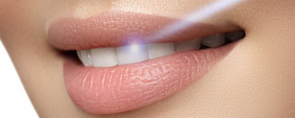 种植牙齿怎么选择材料