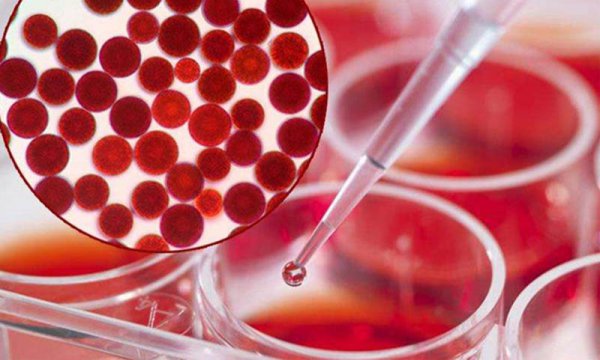 小龙虾的由来历史及发展过程