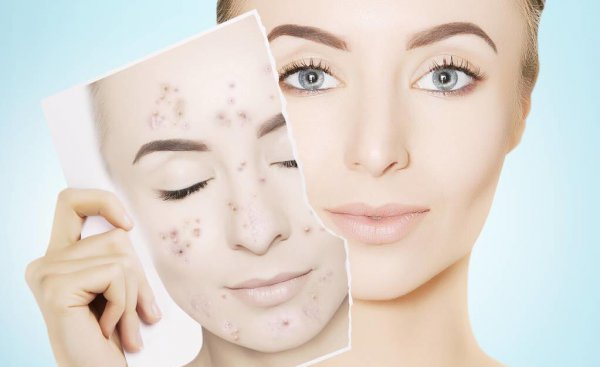 烟酰胺长毛是真是假理论依据