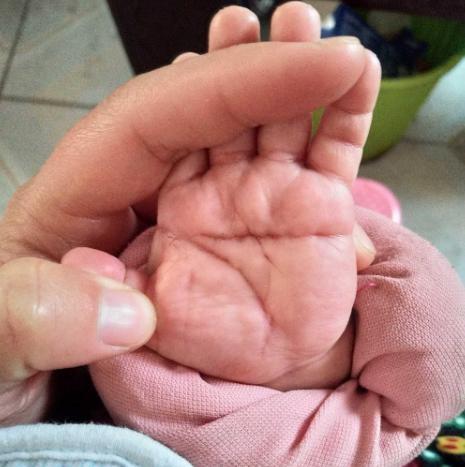 小孩子断掌是吉还是凶