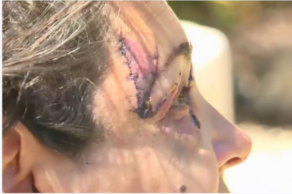 袋鼠是哪个国家的国宝动物