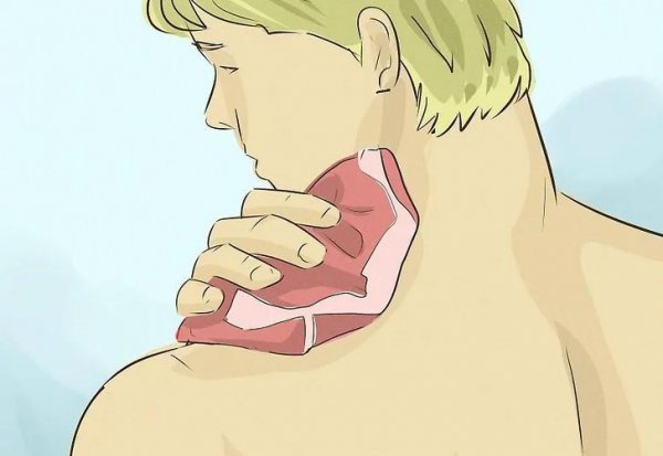 亲的草莓印一分钟去除