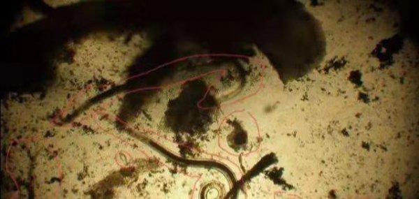 根结线虫用什么治简单彻底