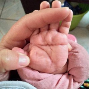 小孩子断掌是吉还是凶 新生宝宝是断掌是富贵的象征吗