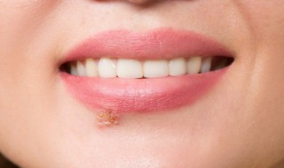 唇彩弄衣服上怎么洗 唇彩弄衣服上清洗方法