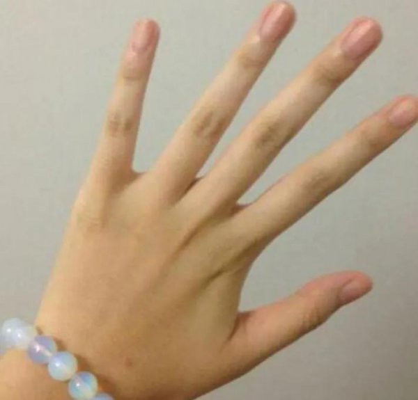 小拇指短一截有什么说法