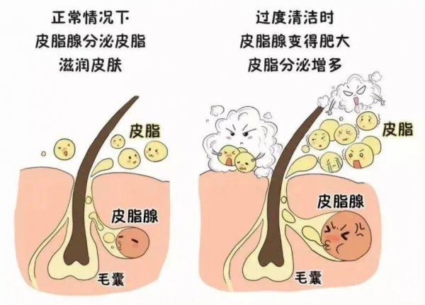 头发为什么越来越油