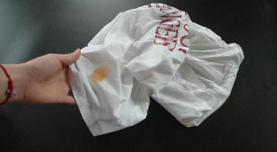 衣服上的油渍怎么去除小窍门 怎么去掉衣服上的油渍