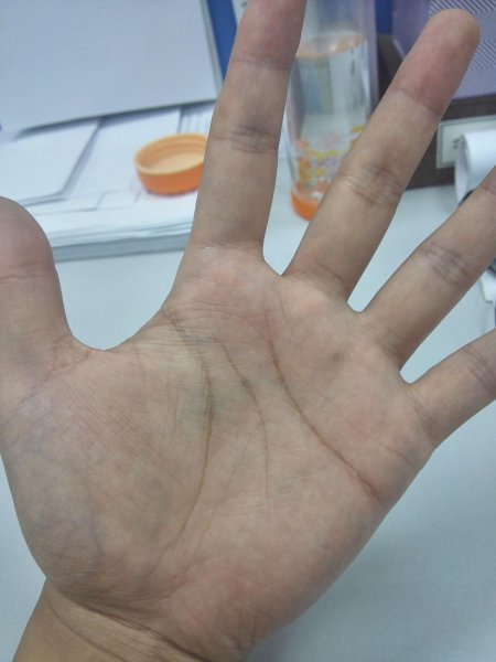 女人有川字纹是什么命