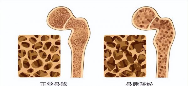 5种人不能吃无花果