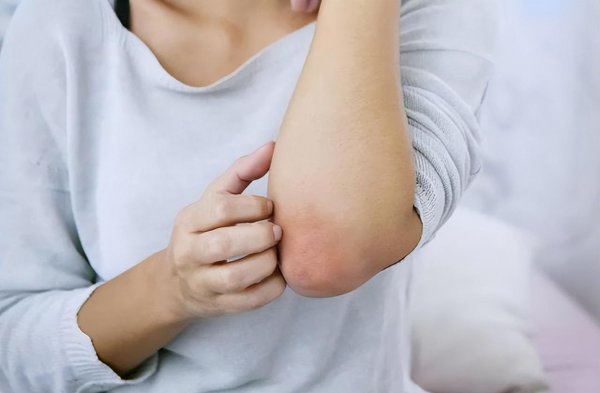 5种人不能吃无花果