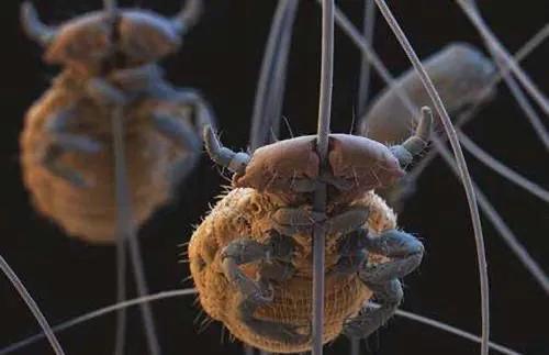 虱子的由来这是怎么长出来的