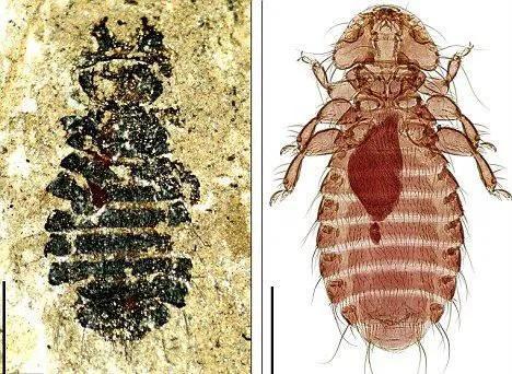 虱子的由来这是怎么长出来的