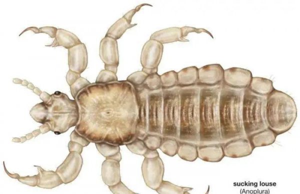 虱子的由来这是怎么长出来的