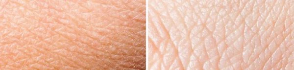 霜和乳液的区别是什么意思