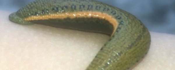 蚂蟥咬人怎么办