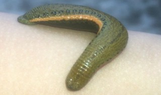 蚂蟥咬人怎么办 蚂蟥咬人应该怎么办