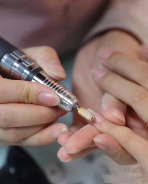 卸甲片的方法小妙招