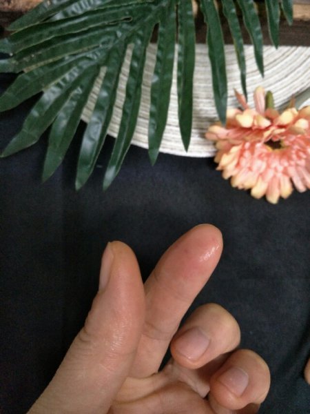 520胶水粘到手怎么去掉