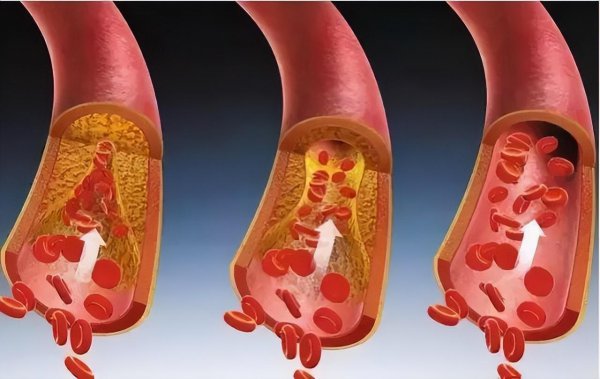 百香果哪三类人不能吃