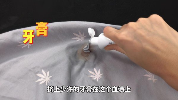 床单上的血渍怎样快速清除