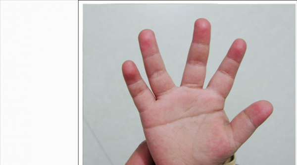 女人断掌有什么说法吗