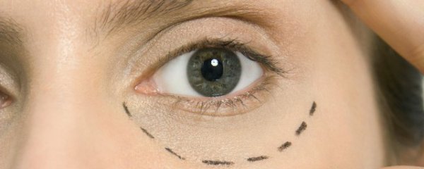 眼睛下面皱纹怎么去除