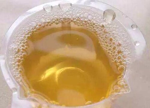 尿液可以直接浇花吗