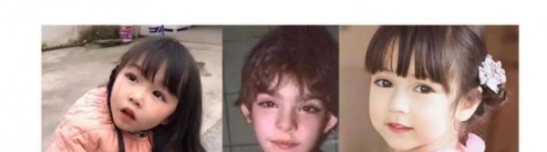 长得好看的病叫什么