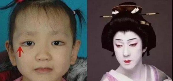 长得好看的病叫什么