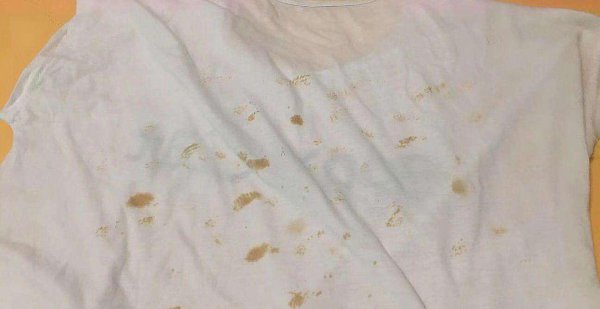 白衣服为什么会发黄