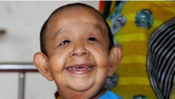 近亲结婚是指几代以内