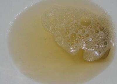 人尿能浇花吗 人尿浇花好吗