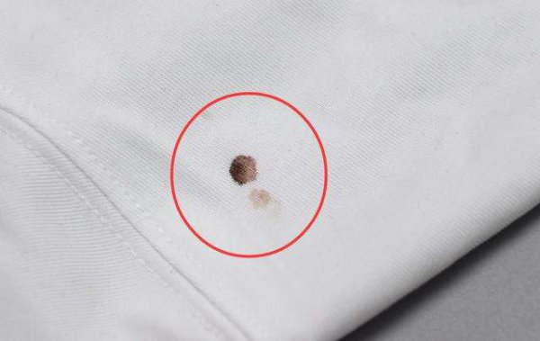 衣服上有血渍怎么清洗最有效